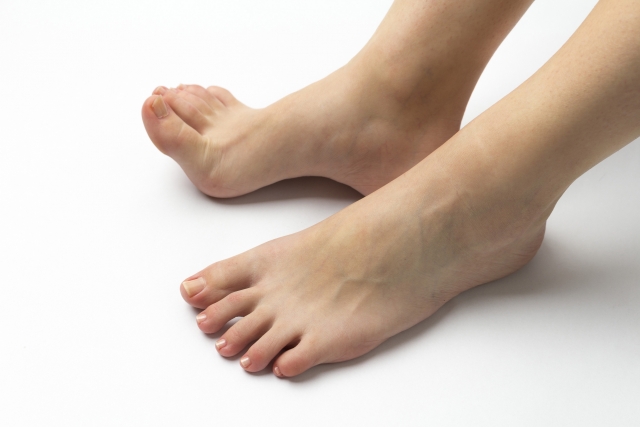 角質やタコの場所 靴が合わないと歩き方が分かる 爪専門店nailclinique 東京 福岡 名古屋 岡山 自爪育成 深爪矯正