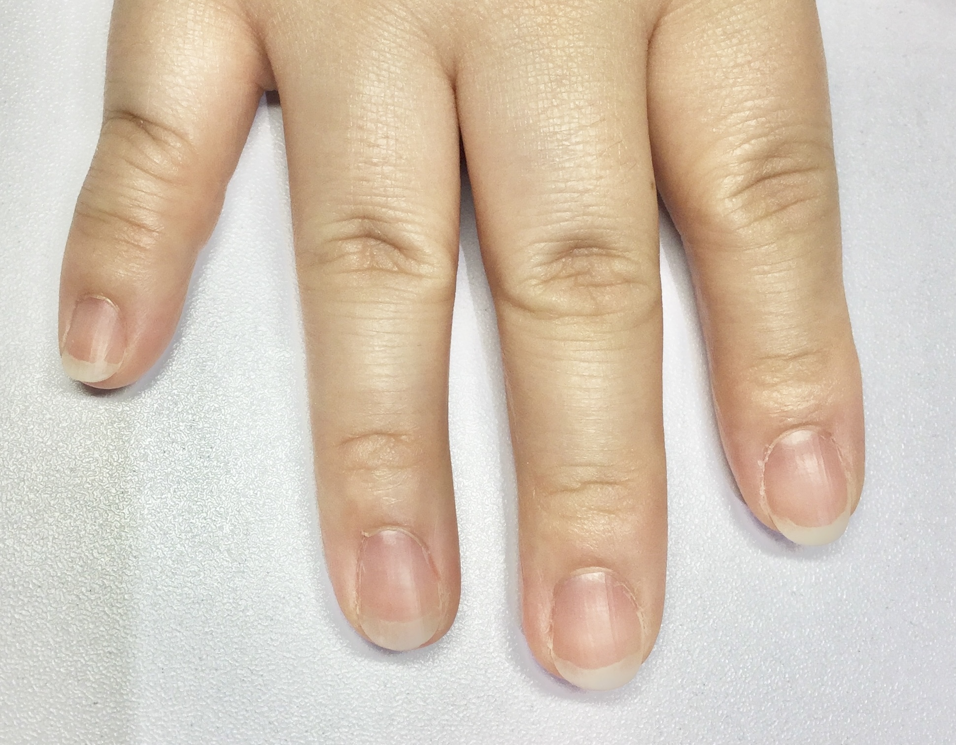 Before