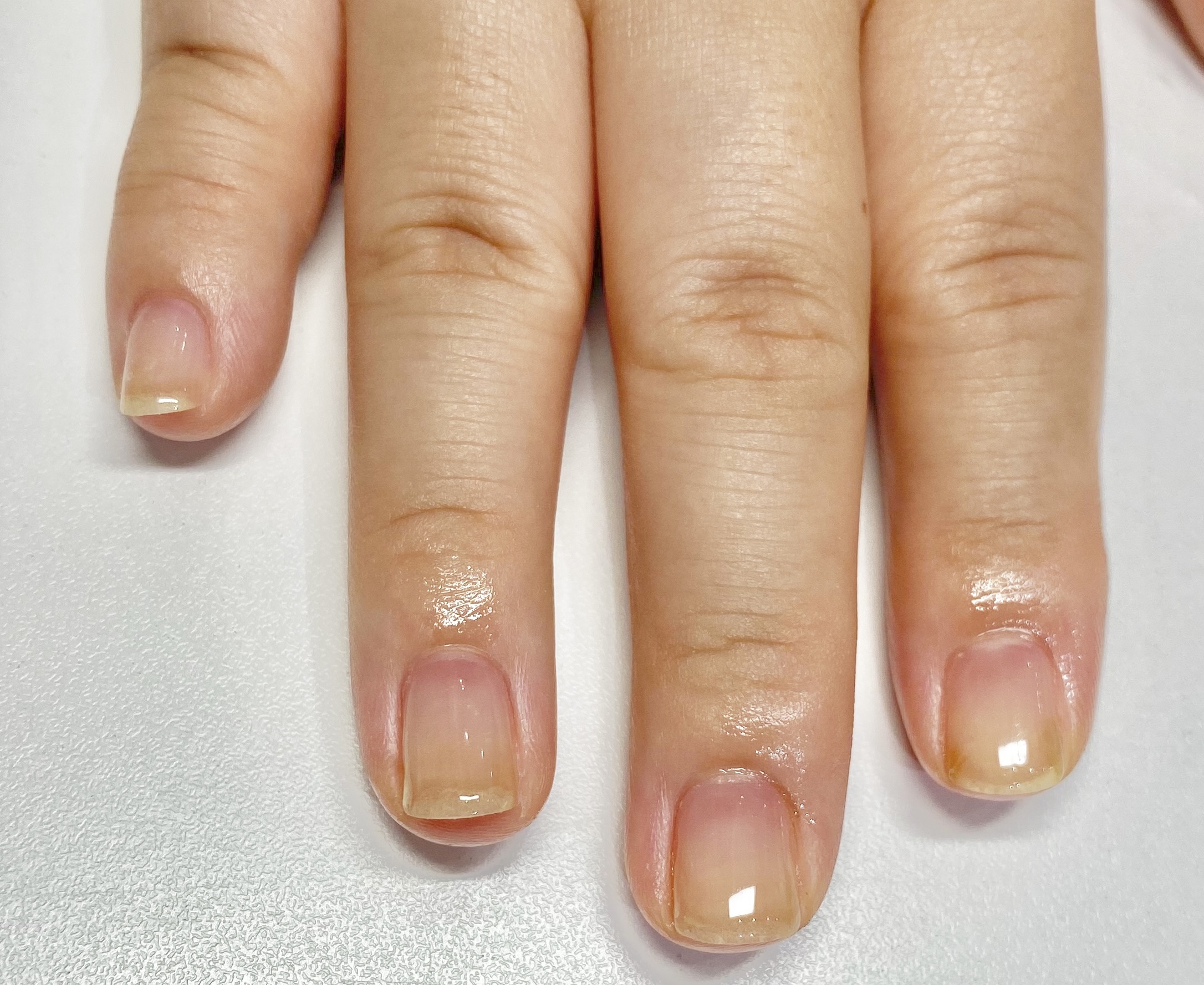 After