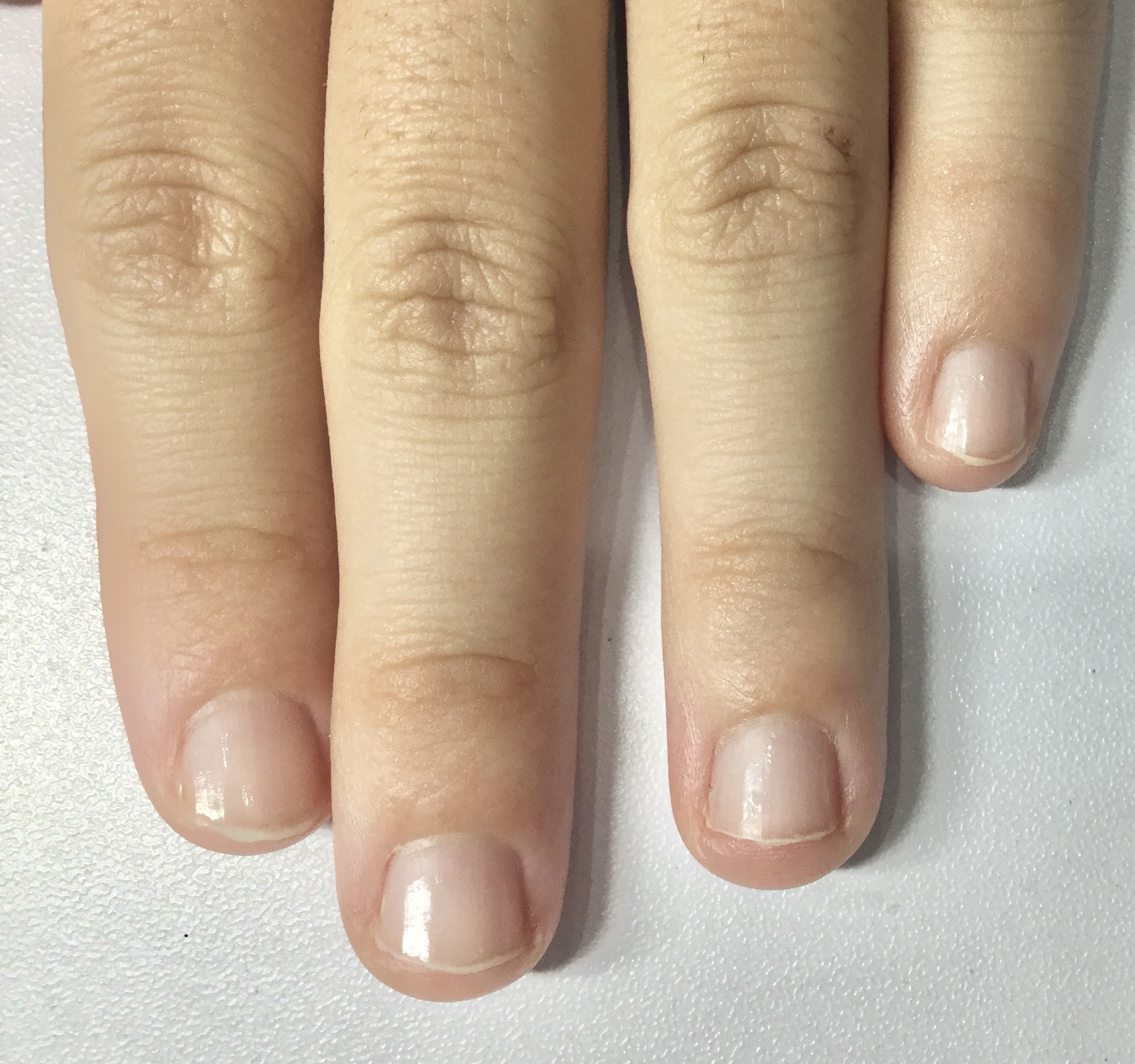 Before